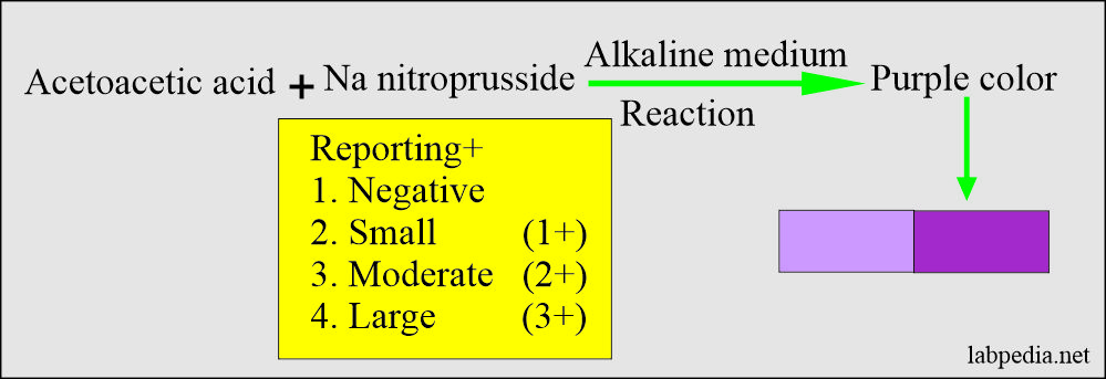 Urine Analysis: Part 3 – Complete Urine Analysis – Labpedia.net