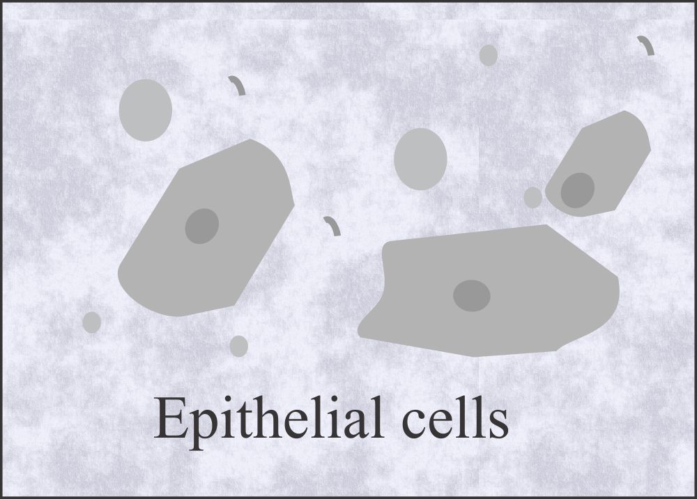 Urine squamous epithelial cells