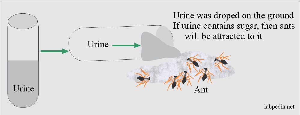 Urine Analysis: Part 1 – History of Urine, Urine Composition, Normal
