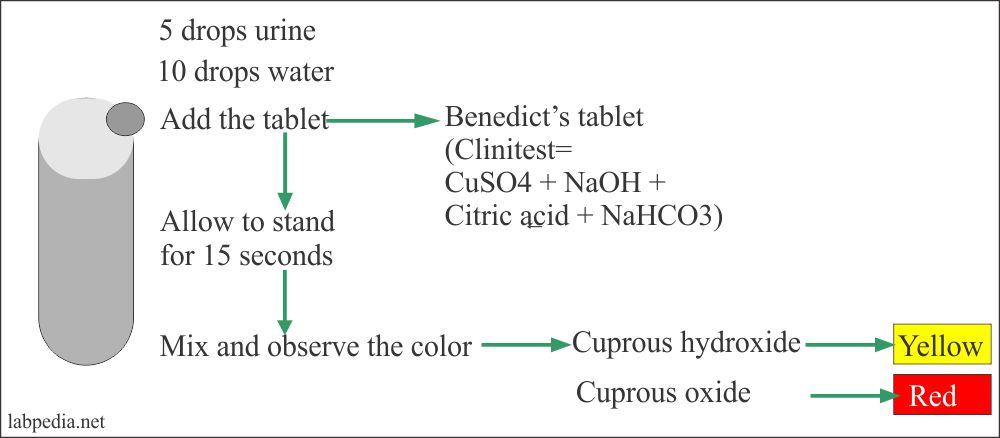 Diabetes Mellitus Part 5 Glucose In Urine Glycosuria Urine Sugar Benedict S Solution Labpedia Diabetes Mellitus Part 5 Glucose In Urine Glycosuria Urine Sugar Benedict S Solution Labpedia