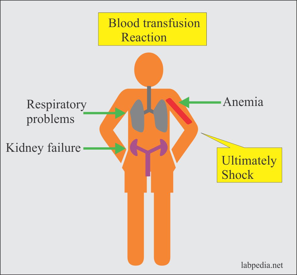 Blood banking:- part 4 – Blood Transfusion Reactions in Donor and Recipient, Adverse reactions due to Blood and Blood Products, Treatment of Reactions
