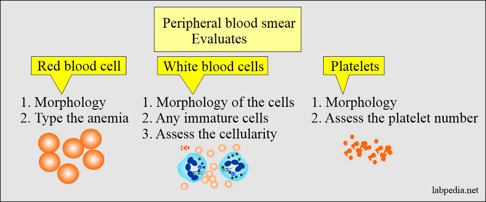 Evaluation by the peripheral blood smear