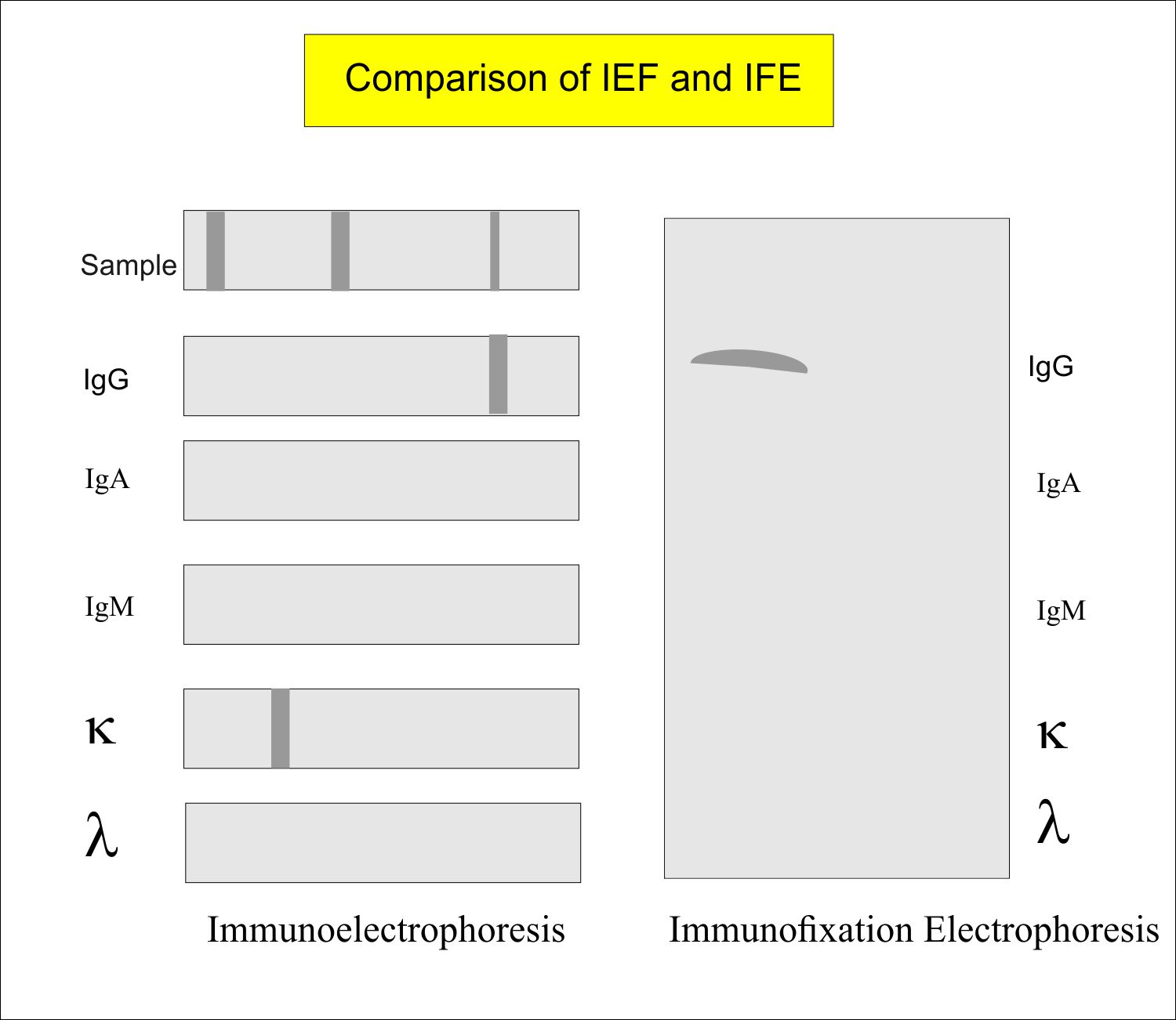 Immunofixation Electrophoresis