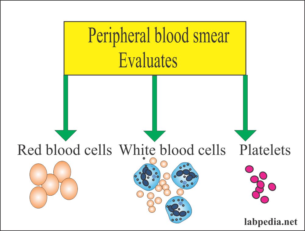 Peripheral blood smear evaluation