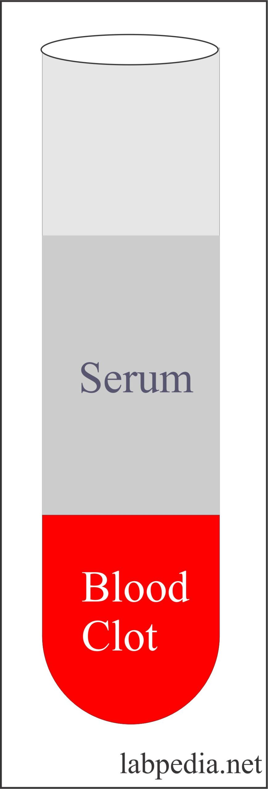 Laboratory Part 1 Serum, Plasma Preparation, Specimen Storage