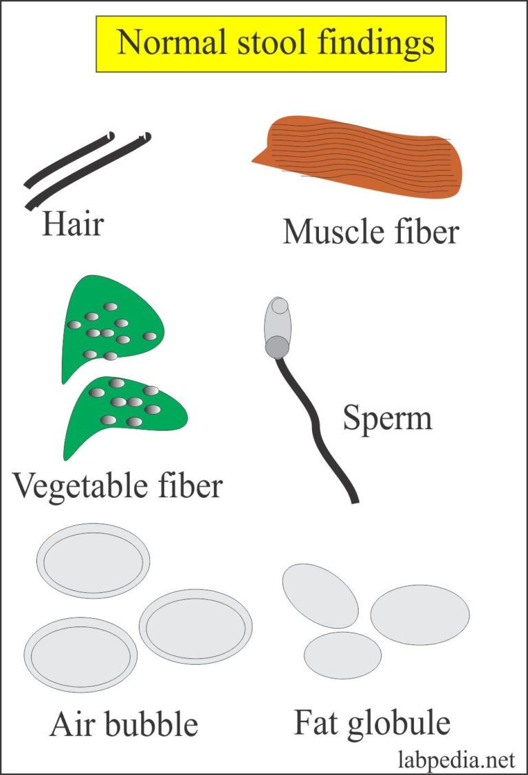 Stool Examination Part 1 Stool Analysis , Complete Stool studies