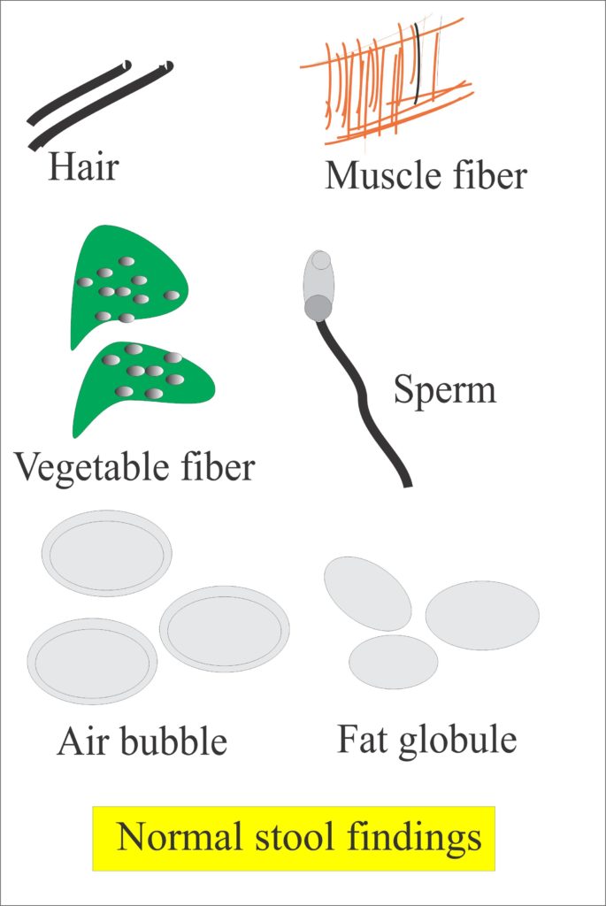 Stool Examination Part 1 Stool Analysis , Stool for ova and