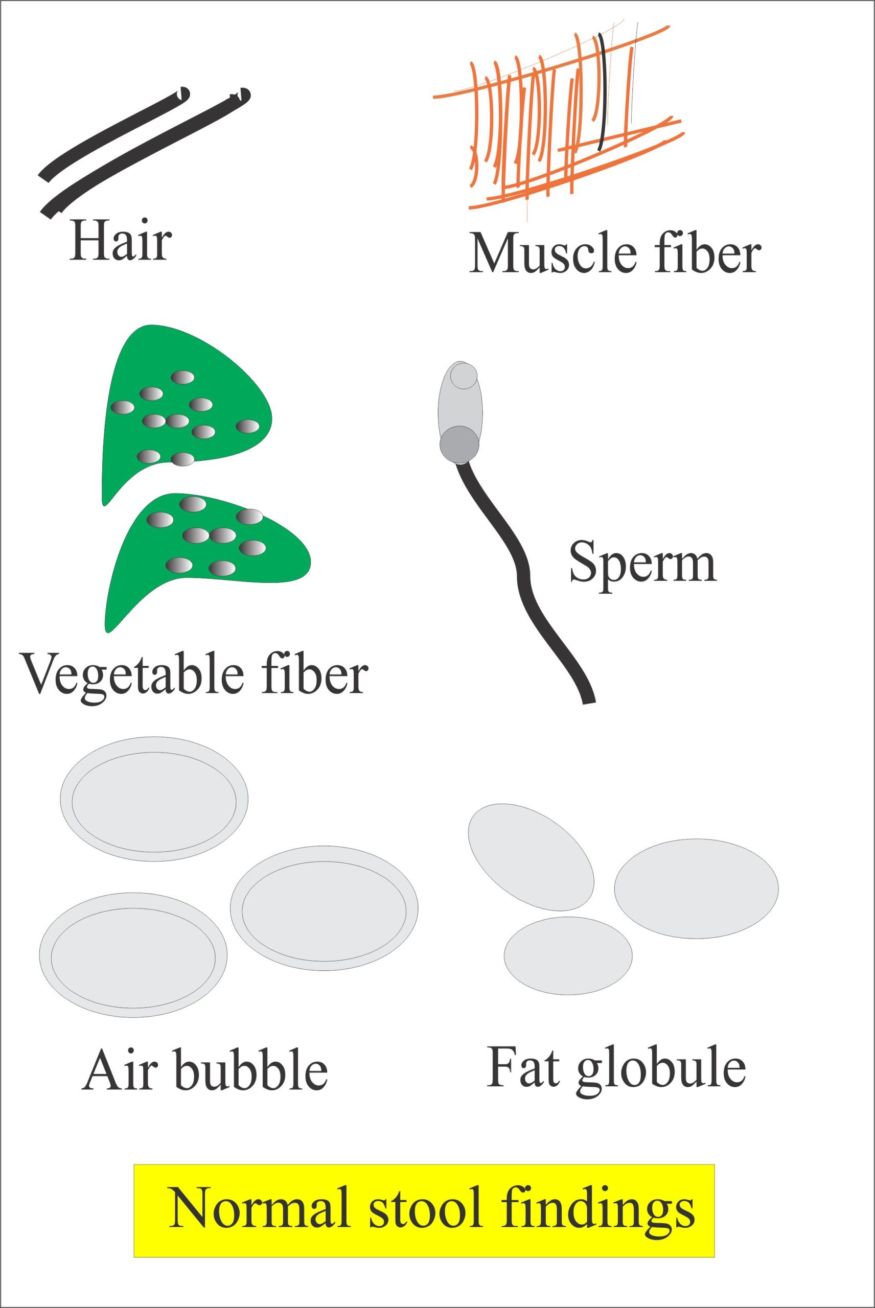 Stool Examination Part 2 Normal Stool Findings