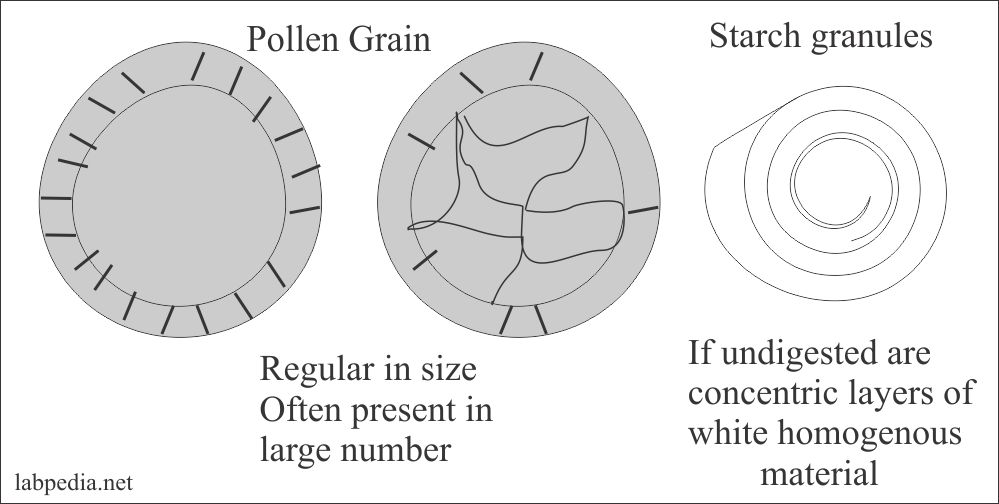 Stool Examination Part 1 Stool Analysis , Complete Stool studies