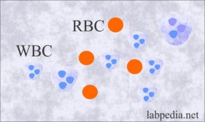 Stool examination: Stool with the presence of WBCs and RBCs