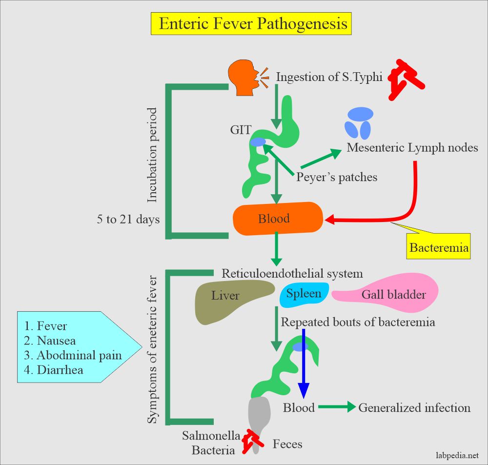 Enteric fever Part 2 Typhoid / Enteric fever Diagnosis, Widal test