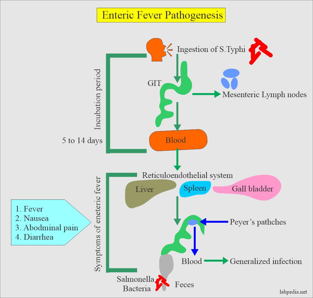 Typhoid fever pathogenesis and cycle