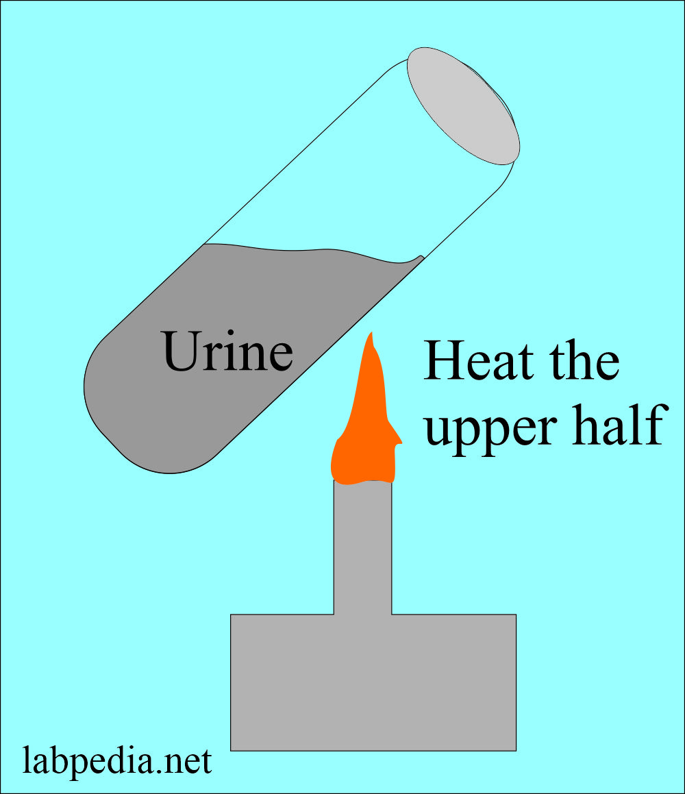 Urine heat test for the protein