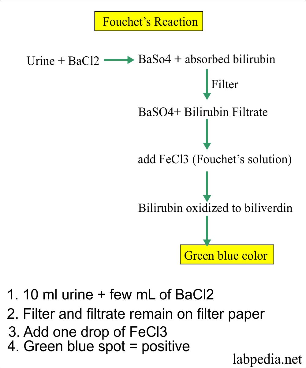 Urine Analysis Part 10 Bilirubin in Urine (Bilirubinuria)