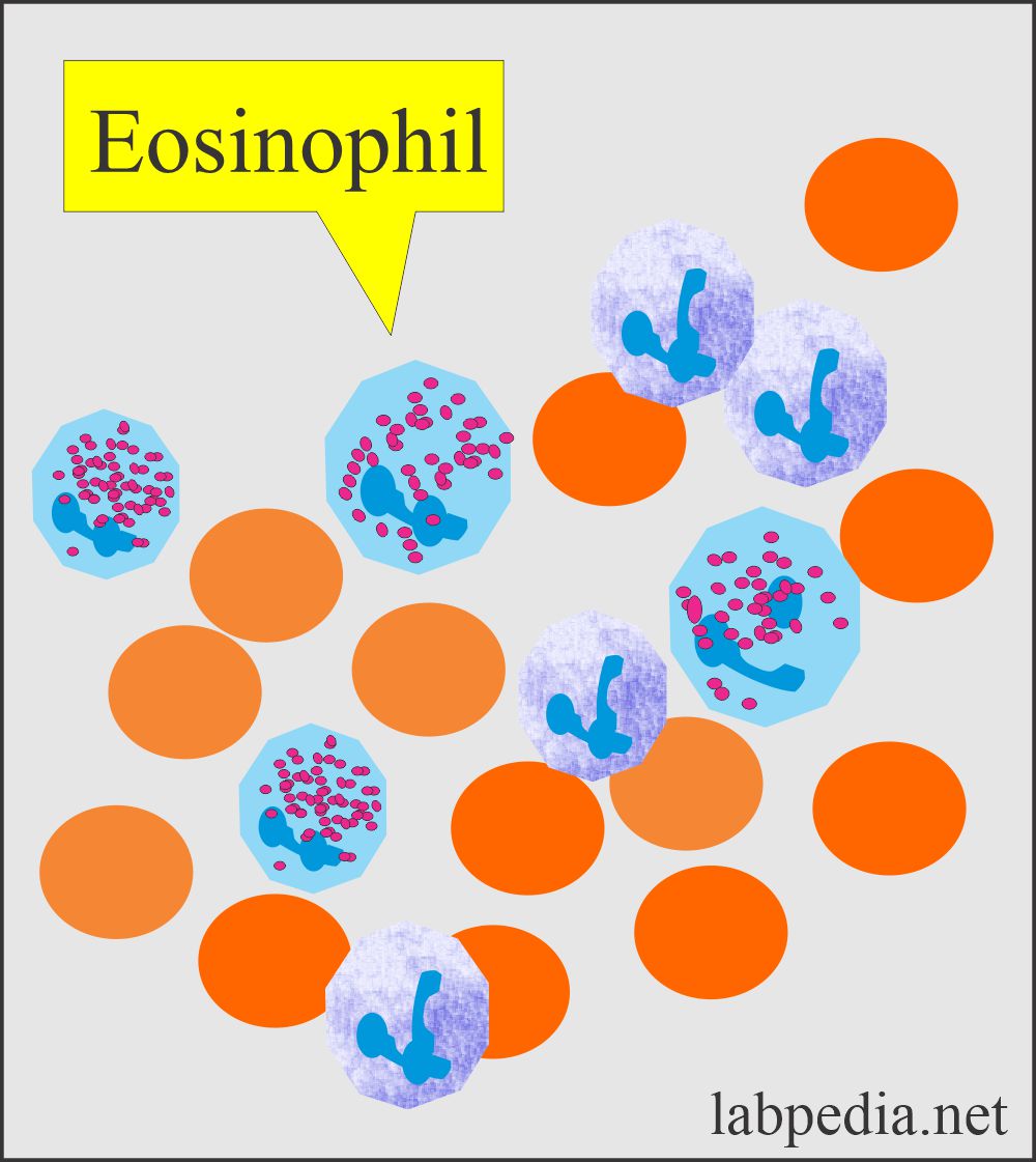 Urine eosinophils