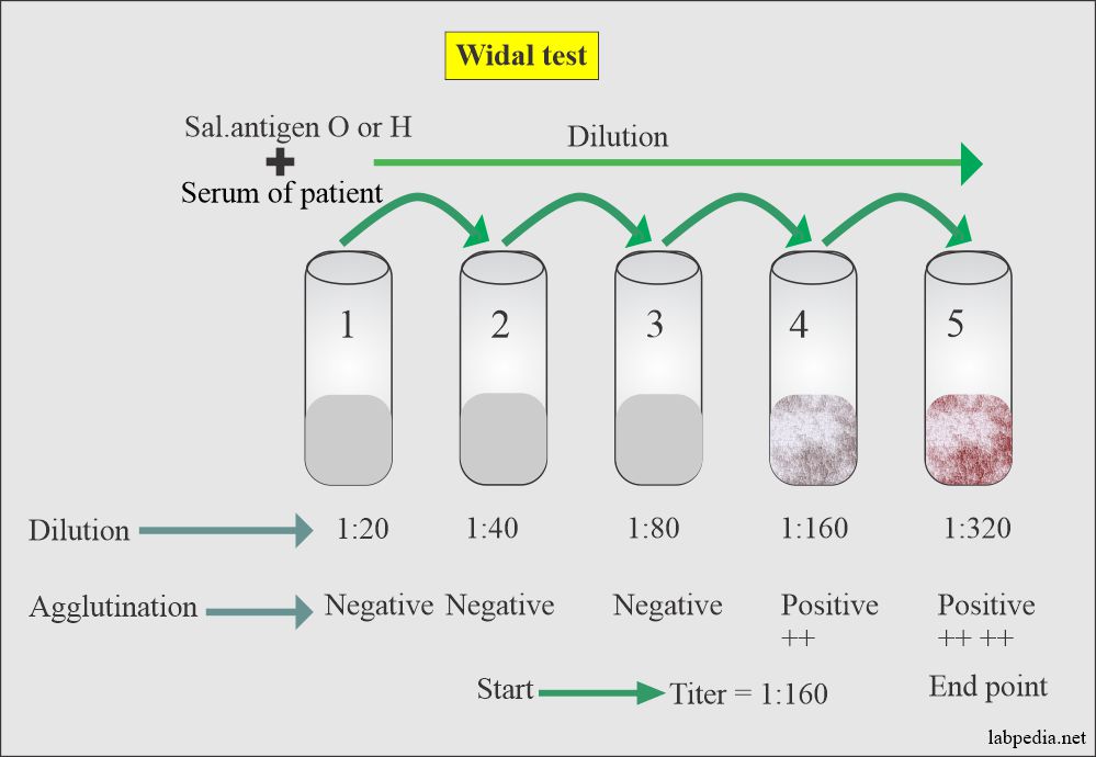 The procedure of the widal test and reporting