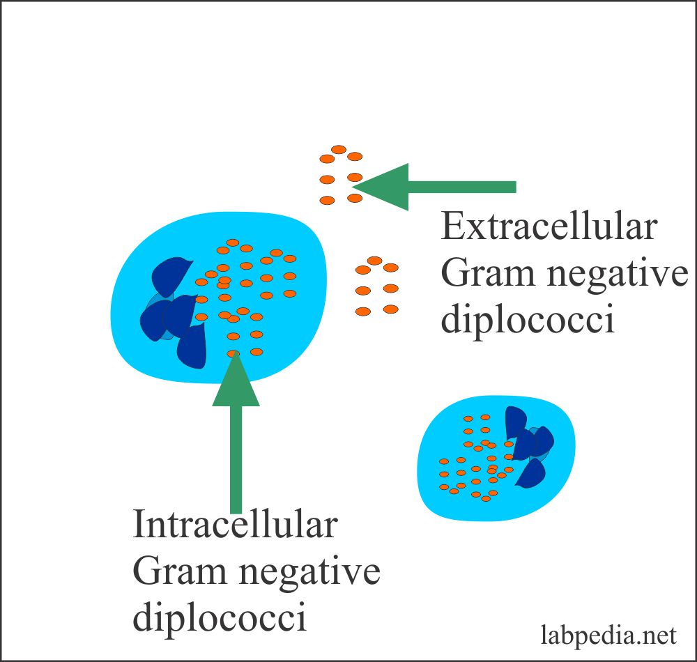 Neutrophils with phagocytosis