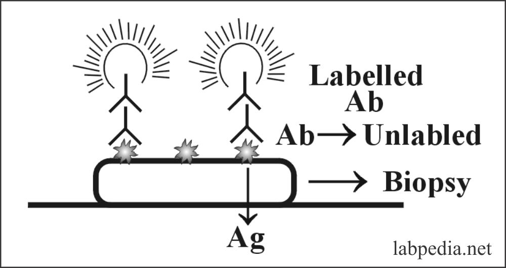 Fig 170: Indirect Fluorescent Antibody
