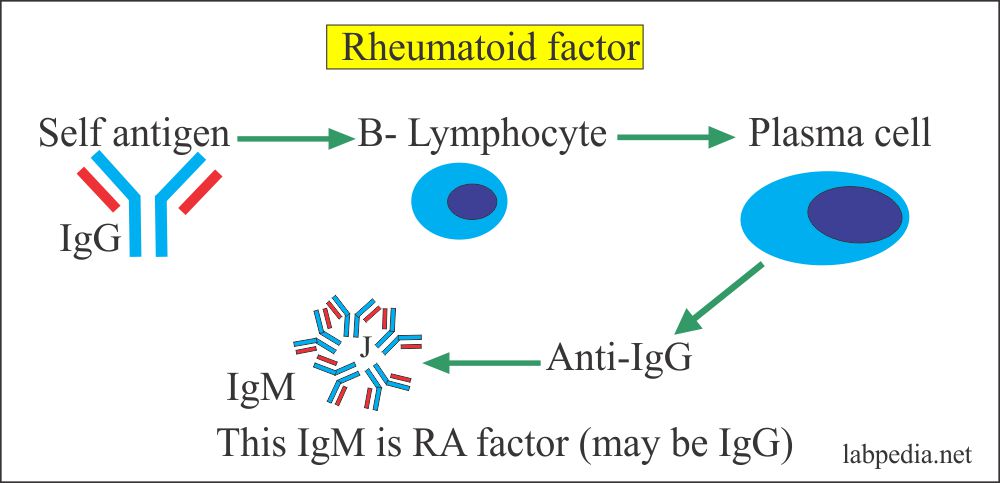 Formation of Rheumatoid factor (RF)