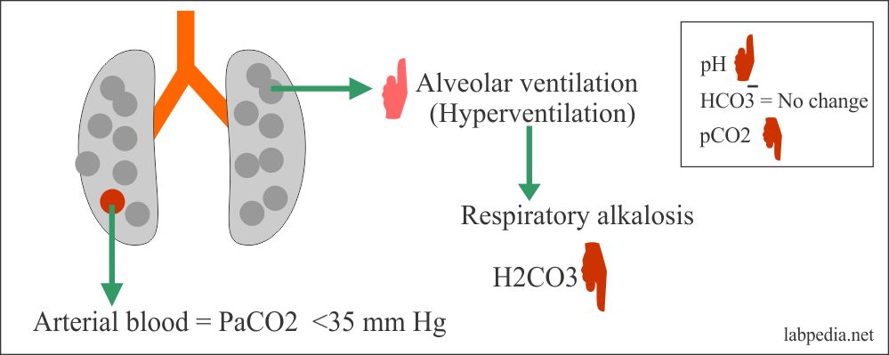 Respiratory alkalosis ph