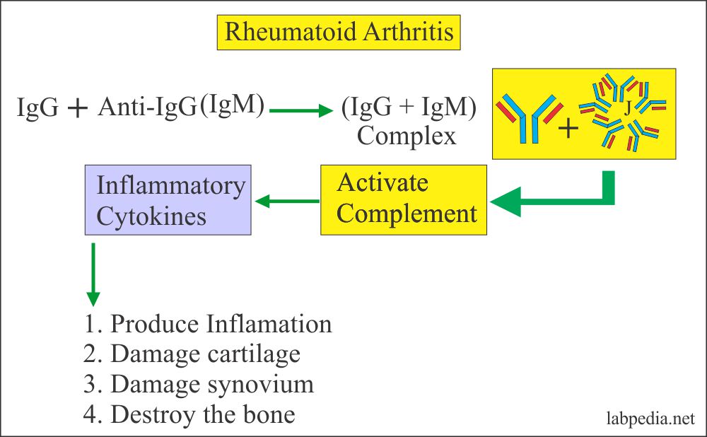 Mechanism of injury in Rheumatoid Arthritis