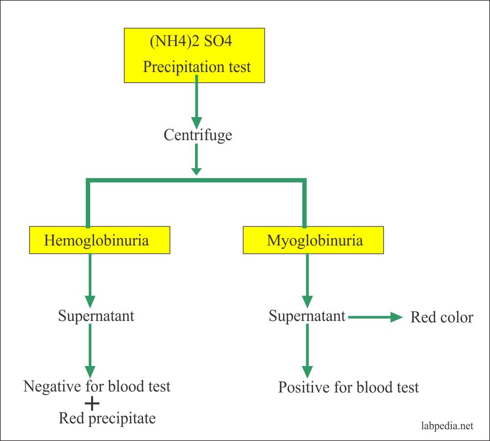 Urine (NH4)2SO4 concentration test