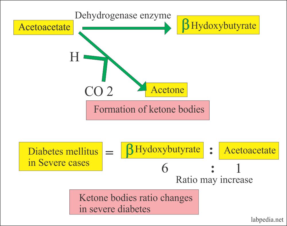 ketone bodies and their ratio
