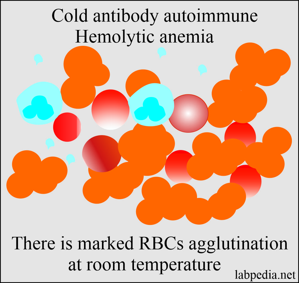 Cold antibody autoimmune hemolytic anemia