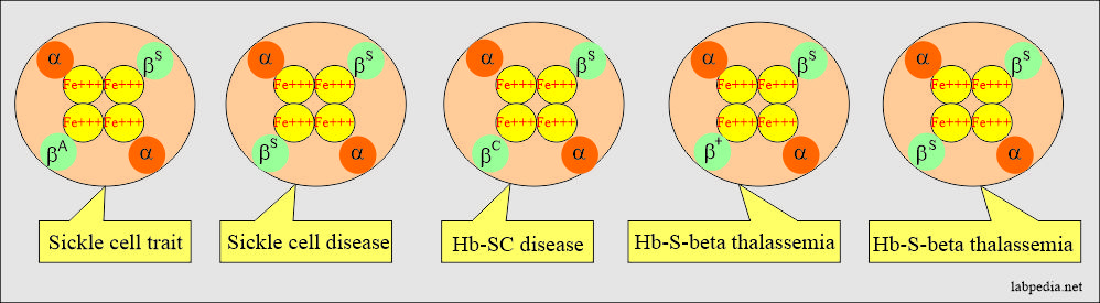 Sickle cell disease and its combinations