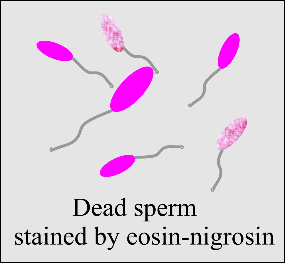 Semen viable sperm stained by eosin-nigrosin stain