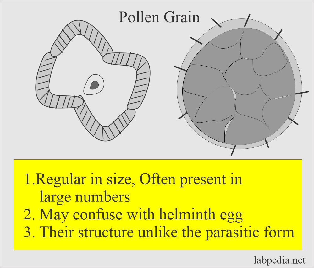 Stool examination: Stool showing pollen grains 