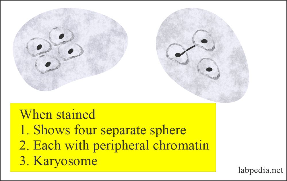 Stool showing polymorphonuclear leukocyte (PMN) 