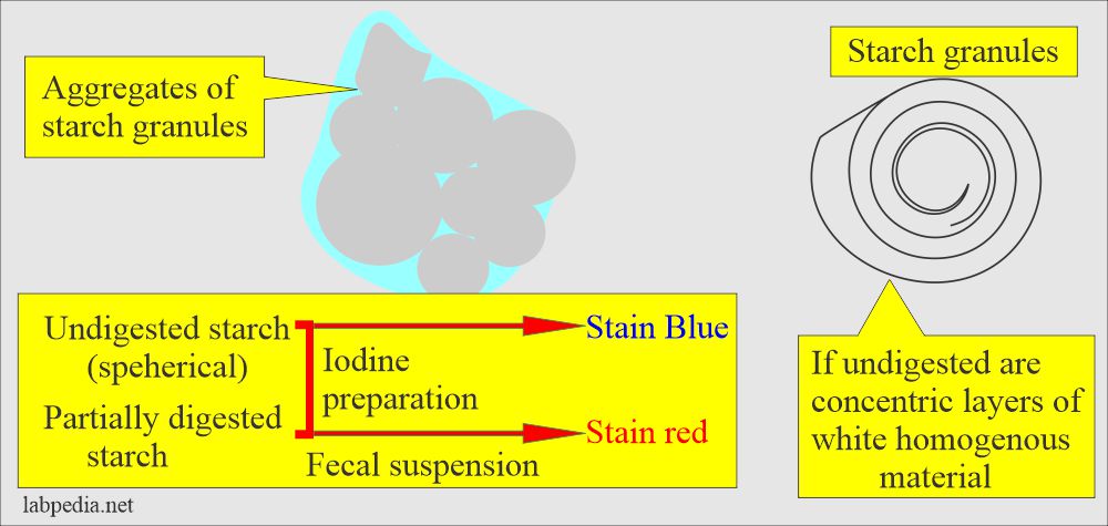 Stool starch and iodine stain of starch result